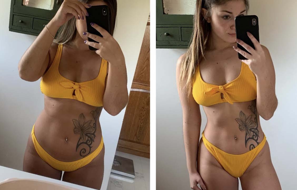 before and after bikini